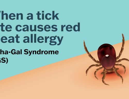 Living with Alpha-Gal: From Tick Bites to Medicine Bottles